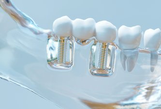 Photo Vedcom sa podarilo v laboratóriu vypestovať ľudský zub 