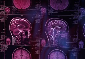 Photo Bunky obličiek ukázali, že pamäť nesídli len v mozgu