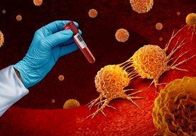 Photo Prelom v diagnostike rakoviny zo vzoriek krvi už 3 roky pred prvými príznakmi