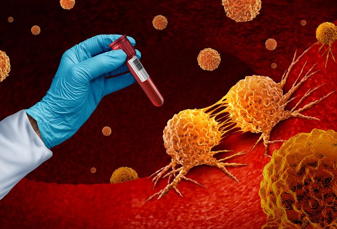 Photo Prelom v diagnostike rakoviny zo vzoriek krvi už 3 roky pred prvými príznakmi