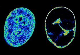 Photo Vírus herpesu dokáže zmeniť náš genóm už za pár hodín od infekcie