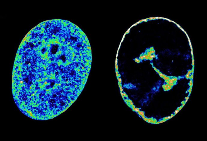 Photo Vírus herpesu dokáže zmeniť náš genóm už za pár hodín od infekcie