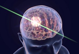 Photo Nová éra vyšetrovania mozgu pomocou svetla