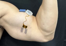 Photo Nový senzor na rameno sleduje hydratáciu tela v reálnom čase