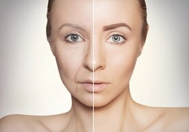 Photo Vedci odhalili kód k omladeniu pleti vďaka pomocníkom z hĺbky našich kostí