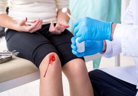 Photo Nový zázračný gél zastaví aj silné krvácanie v priebehu pár sekúnd