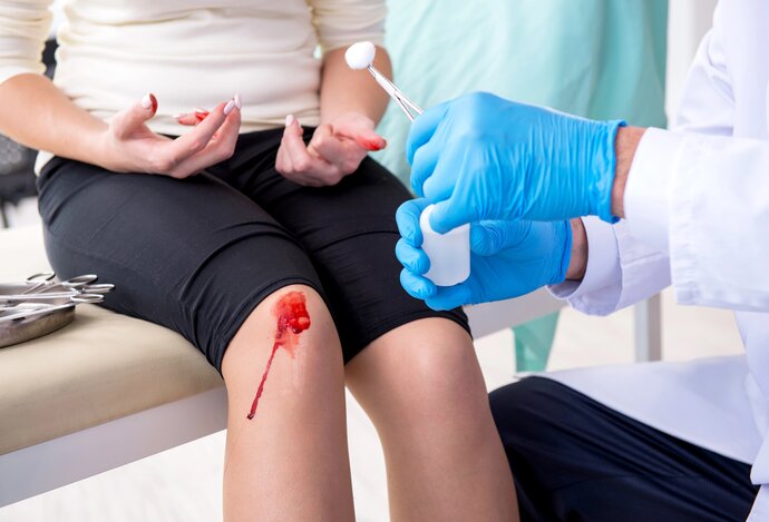 Photo Nový zázračný gél zastaví aj silné krvácanie v priebehu pár sekúnd