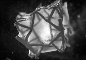 Photo Revolučná 3D záplata so živými bunkami zachráni a vylieči srdce po infarkte 