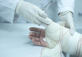 Photo Prevratné riešenie na opravu zlomených kosti priamo na operačnom sále za pár minút 