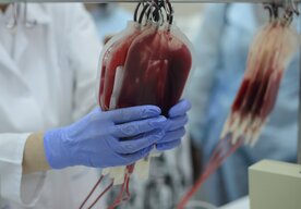 Photo Prelomový filter plazmy pomôže zastaviť masívne krvácanie a zachrániť tisíce životov