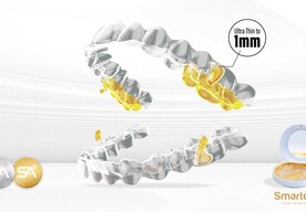 Photo Inovatívne zariadenie odstraňuje nočné chrápanie a zároveň aj vyrovnáva krivé zuby