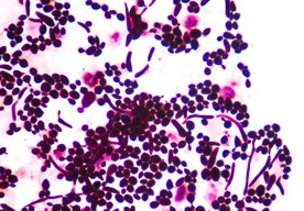 Photo Nový liek zastavuje starnutie na bunkovej úrovni: Je toto kľúč k večnej mladosti?