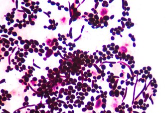 Photo Nový liek zastavuje starnutie na bunkovej úrovni: Je toto kľúč k večnej mladosti?