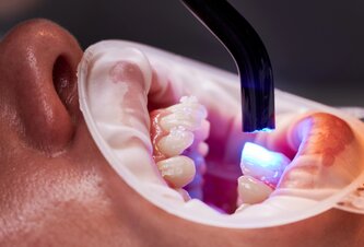 Photo Prelomový gél dokáže opraviť zubnú sklovinu a čoskoro sa môže dostať aj na trh