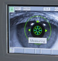 Photo Sken sietnice odhalí, ako rýchlo starnete a či vám hrozí infarkt