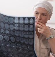 Photo Prelomová chemoterapia zabíja rakovinu 20 000-krát silnejšie a bez vedľajších účinkov