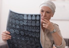 Photo Prelomová chemoterapia zabíja rakovinu 20 000-krát silnejšie a bez vedľajších účinkov