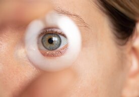 Photo Experimentálna liečba kmeňovými bunkami vrátila zrak pacientom