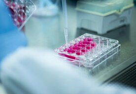 Photo Vedci úspešne omladili starnúce krvné kmeňové bunky  