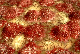 Photo Prelomový objav v boji proti starnutiu: Vedci našli spôsob, ako označiť „zombie“ bunky