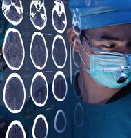 Photo Paralyzovaný muž začal ovládať zariadenia mysľou už po piatich dňoch od implantácie BCI čipu