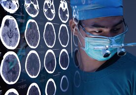 Photo Paralyzovaný muž začal ovládať zariadenia mysľou už po piatich dňoch od implantácie BCI čipu