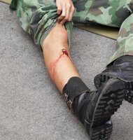 Photo Revolučný prášok zastaví aj veľmi silné krvácanie len za 1 sekundu