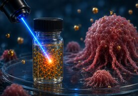 Photo Nanočastice zlata osvietené laserom otvárajú nové možnosti v liečbe rakoviny
