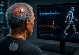 Photo Adaptívny mozgový stimulátor môže pacientom s Parkinsonom vrátiť plynulejšiu chôdzu