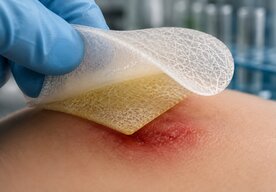 Photo Rastlinný obväz uvoľní antibiotikum skôr, než sa v rane vytvorí biofilm