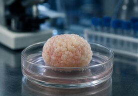 Photo Vedci vypestovali miniatúrne laboratórne mozgy, ktoré si pamätajú svoj vek a vnímajú čas