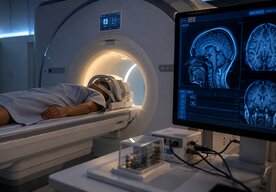 Photo Prvé MRI zariadenie zvládne skenovanie aj modulovanie mozgovej aktivity
