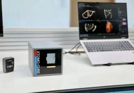 Photo Inžinieri zmenšili technológiu “CTčka” do zariadenia vo veľkosti reproduktora