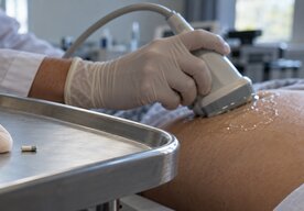 Photo Inovatívne riešenie umožňuje dlhodobo monitorovať a liečiť vnútorné orgány v ľudskom tele bez káblov a batérií