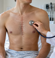 Photo Záhada transplantácií rozlúštená, staré srdce v mladom tele začne mladnúť