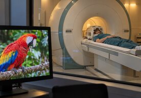 Photo AI dokáže z mozgu prečítať to, na čo sa človek práve pozerá 