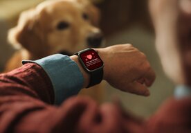 Photo Vyzerajú ako hodinky, tlak merajú ako tlakomer. Huawei Watch D3 prichádzajú na Slovensko